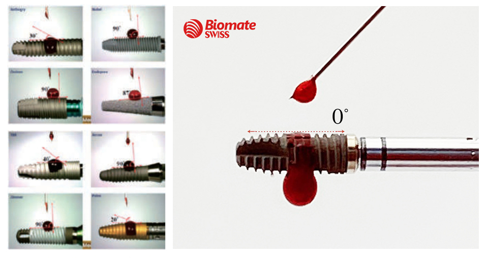 BiomateSWISS Fixture with hemocompatible surface improves the adhesion of protein in the blood, increasing the coagulation of blood.