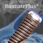 BiomatePlus Implant