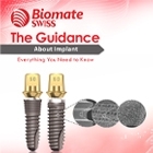 The Guidance-About Implant (Everything you need to know  )